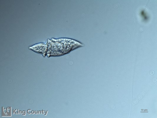 Photo of Gyrodinium spirale